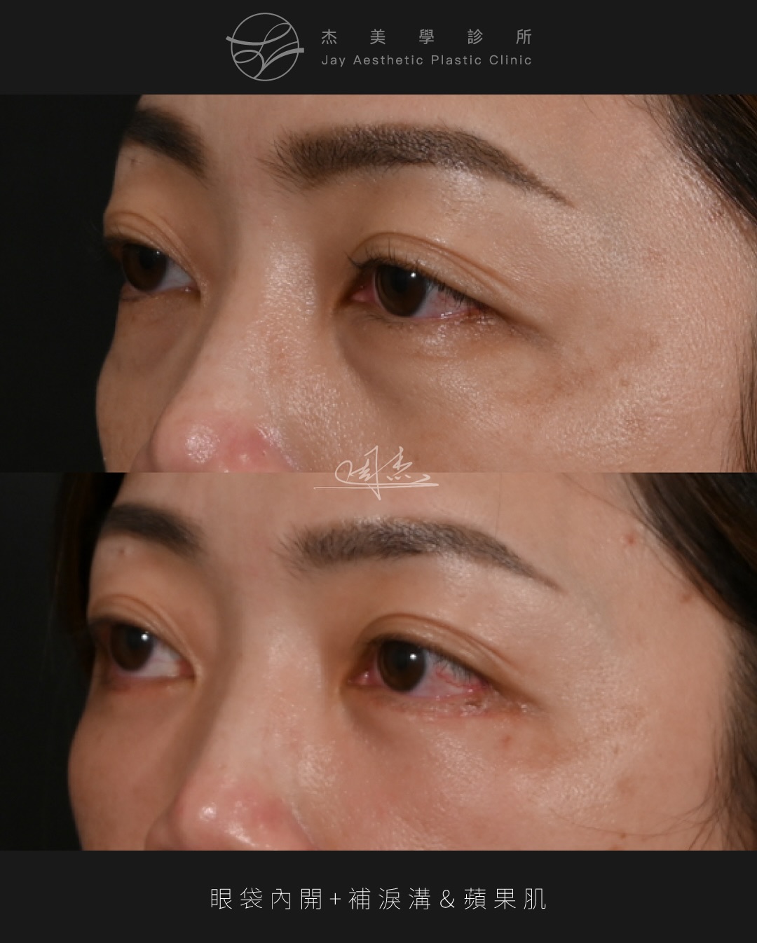 SaveClip.App_628373178_18363104683160158_1431757331436690439_n