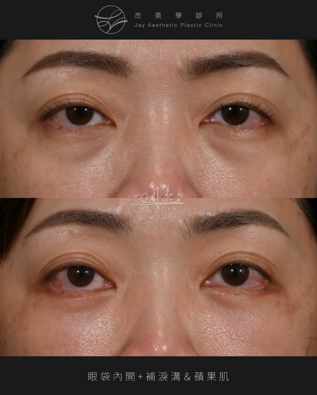 SaveClip.App_629456417_18363104665160158_1047133811136327343_n