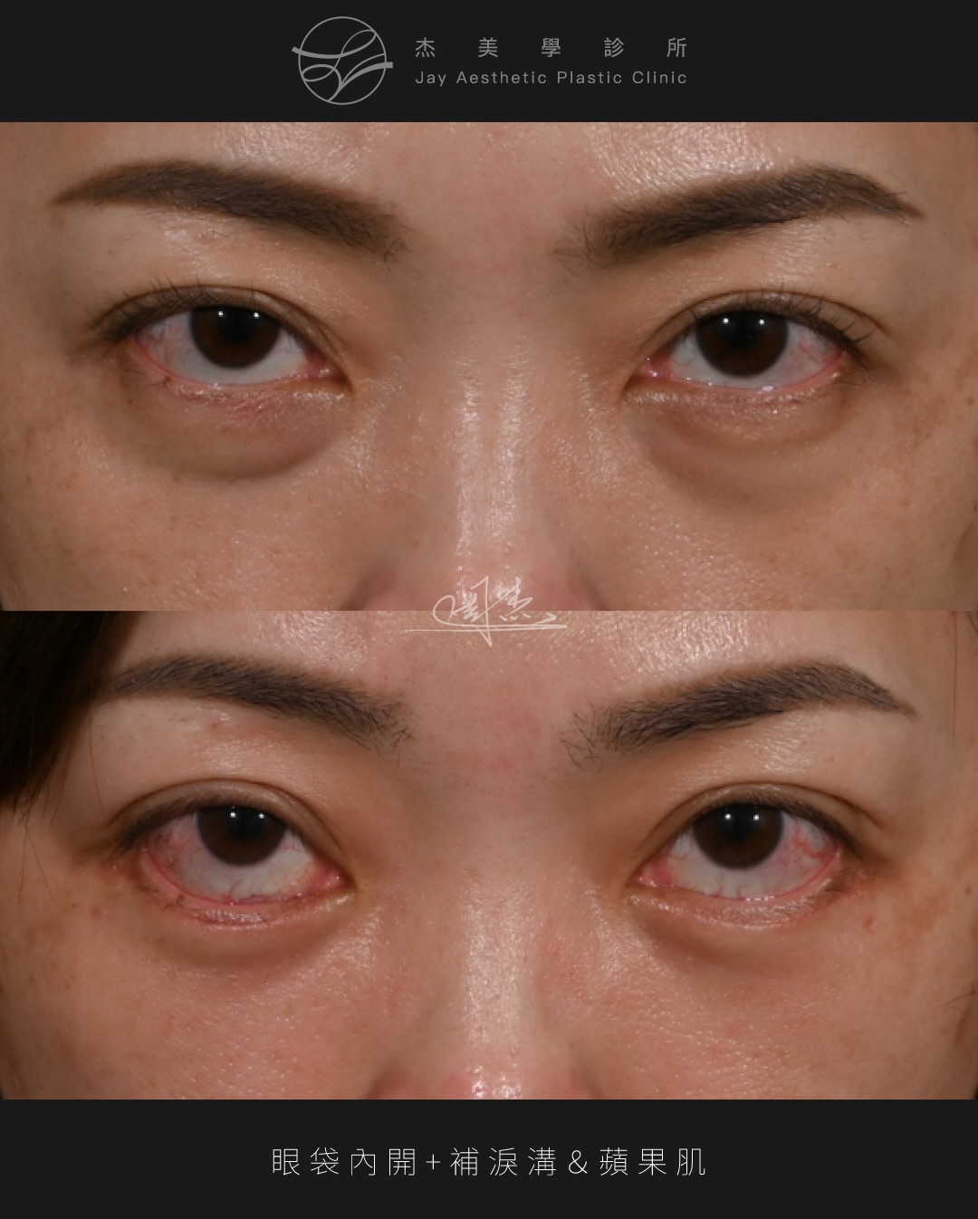 SaveClip.App_629605863_18363104674160158_7465301740606586724_n