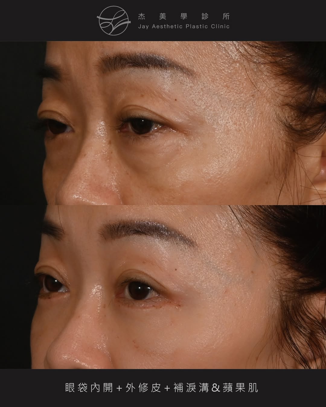 SaveClip.App_641684914_18364660402160158_6546044168450699572_n