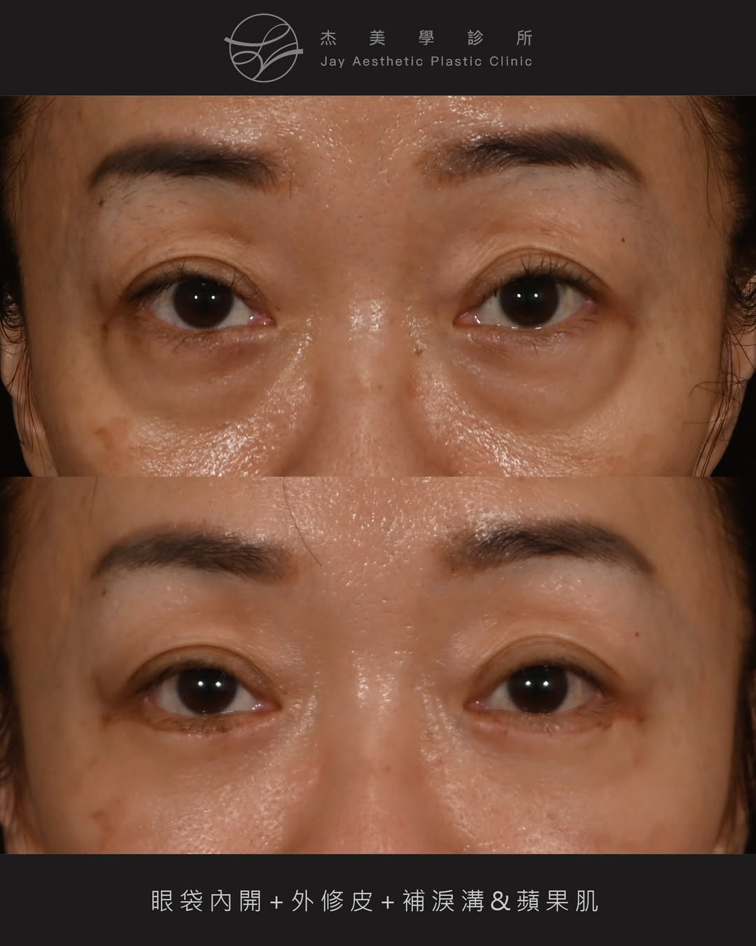 SaveClip.App_641831198_18364660381160158_4678990080777997160_n