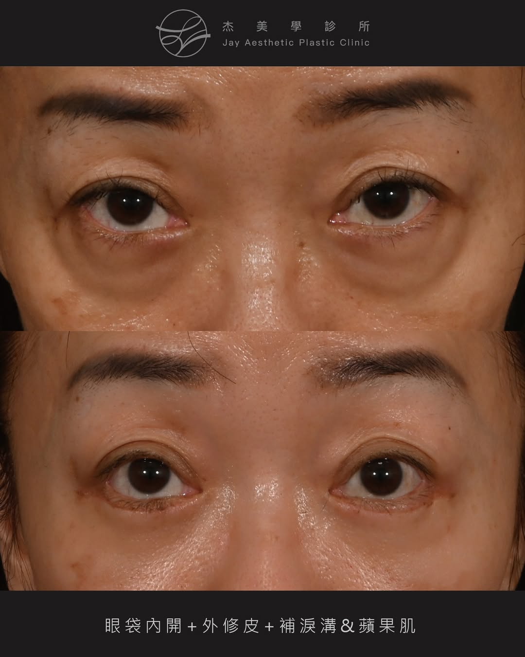 SaveClip.App_642045984_18364660390160158_7337896188908386147_n