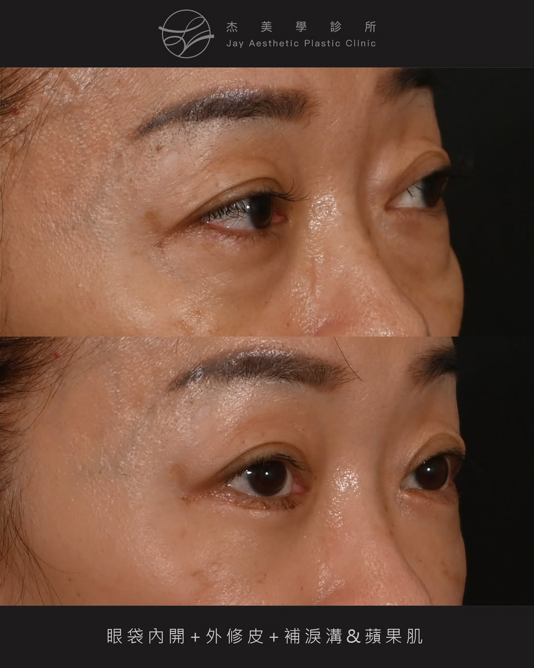 SaveClip.App_642119884_18364660411160158_3074508116148890598_n