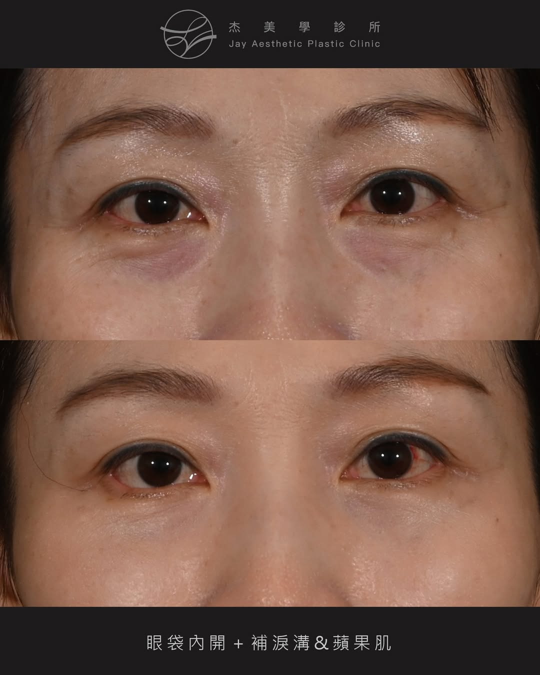 SaveClip.App_642392414_18365068975160158_1894927934726505688_n